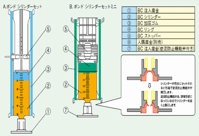 ボンドシリンダー工法